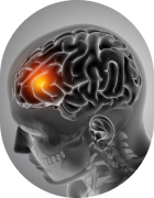 Brain's Health